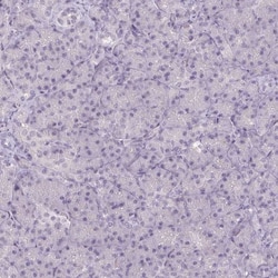 FAM168A Antibody, Novus Biologicals 25 &mu;L; Unlabeled:Antibodies, Polyclonal